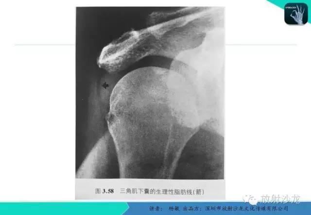 【PPT】滑囊