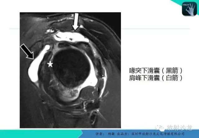 【PPT】滑囊