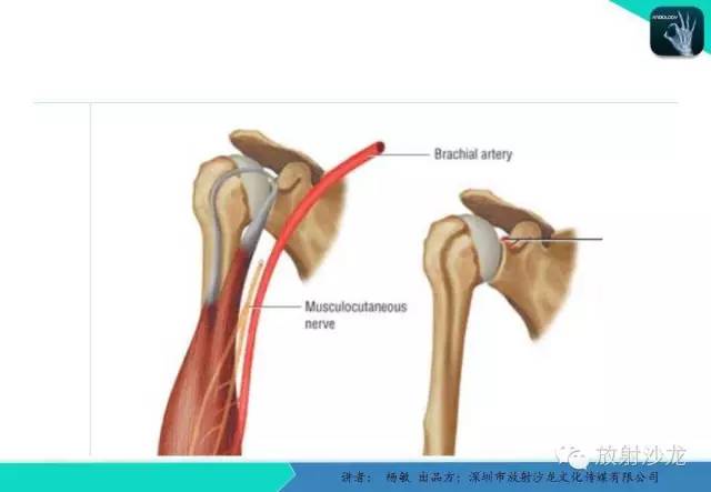 【PPT】滑囊