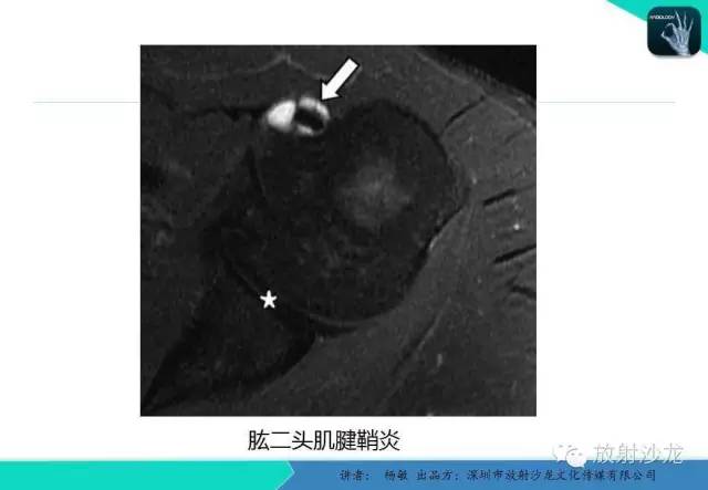 【PPT】滑囊