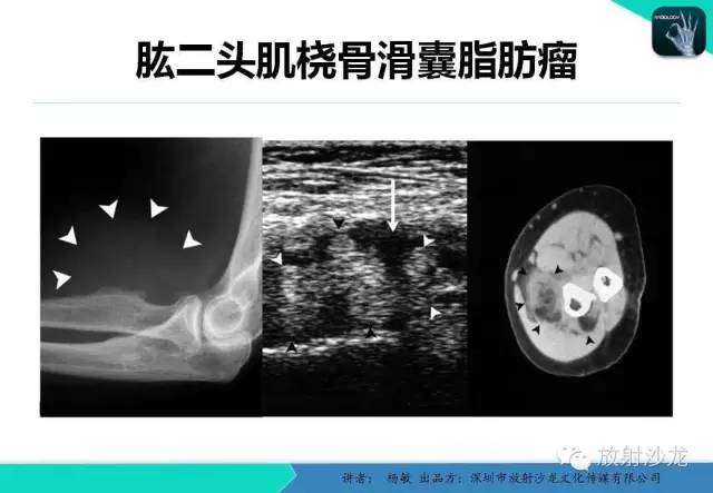 【PPT】滑囊