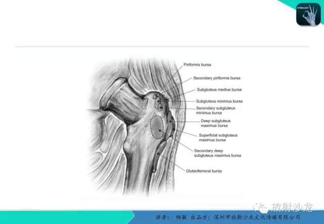 【PPT】滑囊