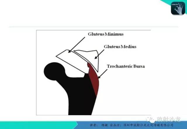【PPT】滑囊