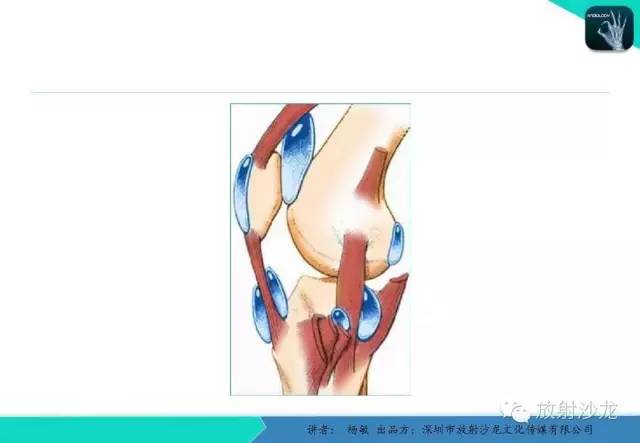 【PPT】滑囊