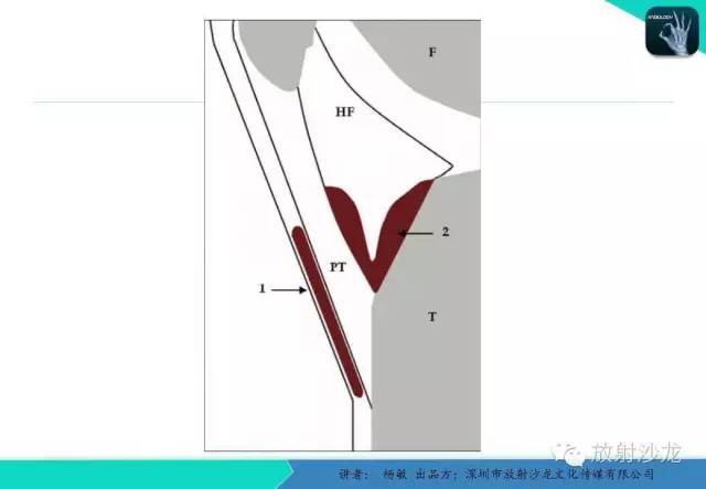 【PPT】滑囊