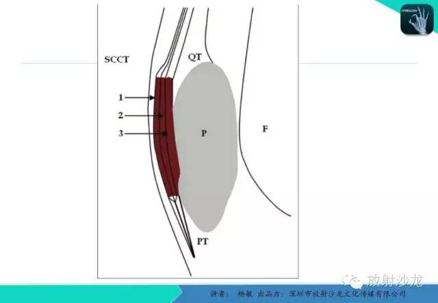 【PPT】滑囊