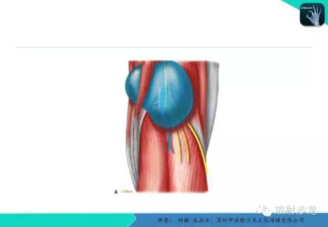 【PPT】滑囊