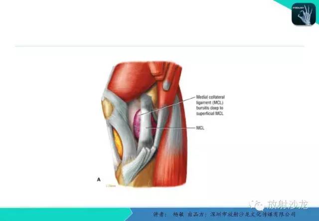 【PPT】滑囊