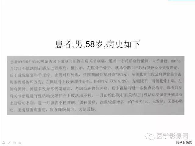 【病例】多发性骨髓瘤1例CT影像表现