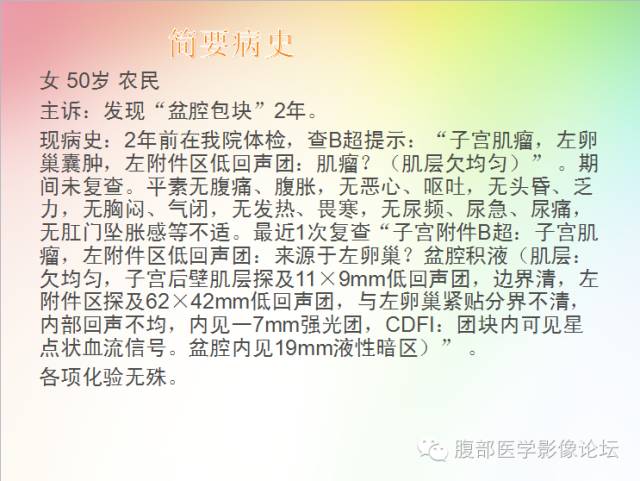 【病例】卵巢卵泡膜纤维瘤1例CT影像表现