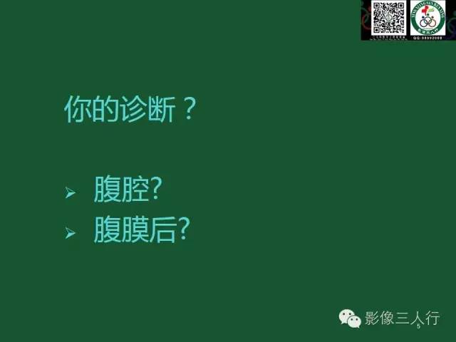 【PPT】腹膜后肿瘤的CT诊断思路