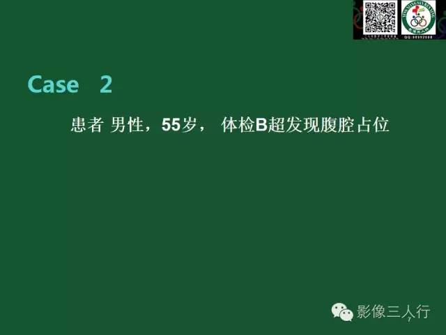 【PPT】腹膜后肿瘤的CT诊断思路