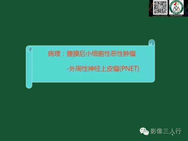 【PPT】腹膜后肿瘤的CT诊断思路