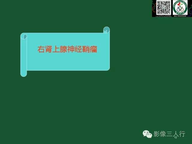 【PPT】腹膜后肿瘤的CT诊断思路