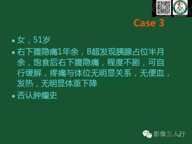 【PPT】腹膜后肿瘤的CT诊断思路