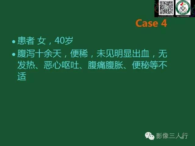 【PPT】腹膜后肿瘤的CT诊断思路