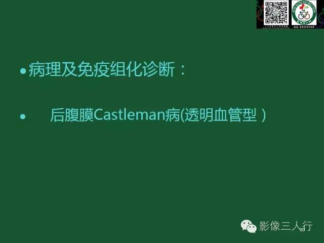 【PPT】腹膜后肿瘤的CT诊断思路