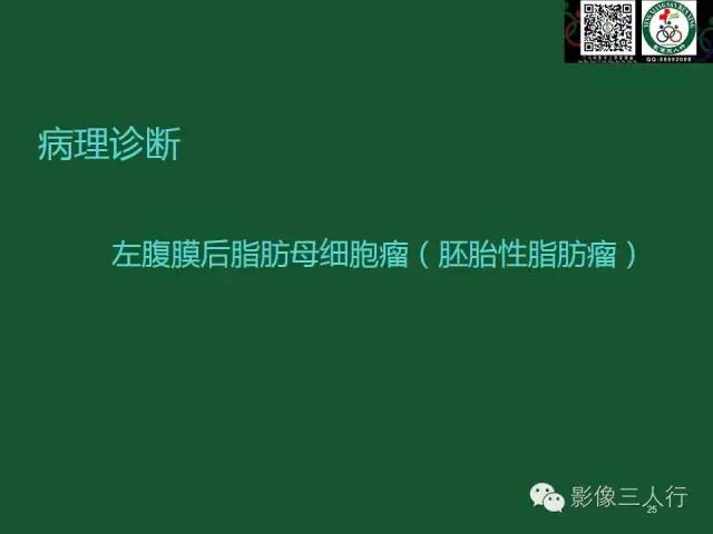 【PPT】腹膜后肿瘤的CT诊断思路