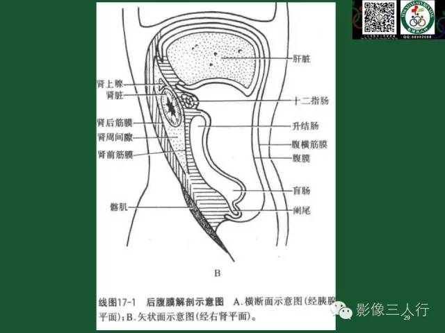 【PPT】腹膜后肿瘤的CT诊断思路