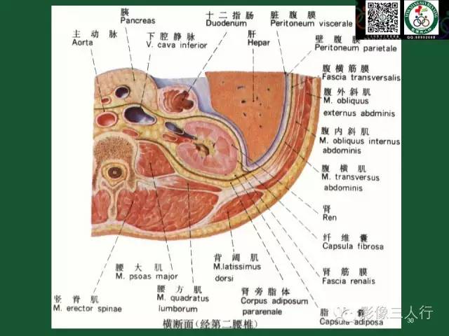 【PPT】腹膜后肿瘤的CT诊断思路