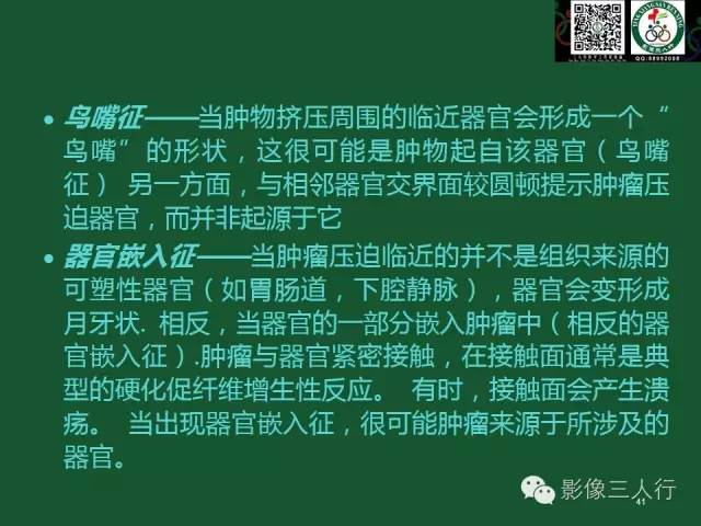 【PPT】腹膜后肿瘤的CT诊断思路