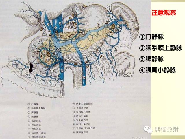 【PPT】胰腺CT增强扫描、血管评价及病变诊断
