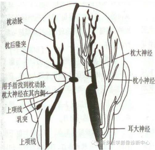 枕大神经卡压综合征 枕大神经卡压综合征