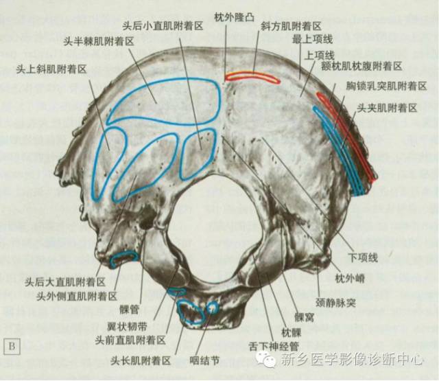 枕大神经卡压综合征 枕大神经卡压综合征