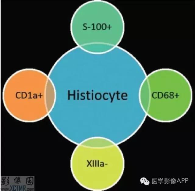 胸部组织细胞病影像学表现 胸部组织细胞病影像学表现