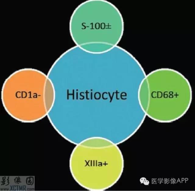 胸部组织细胞病影像学表现 胸部组织细胞病影像学表现