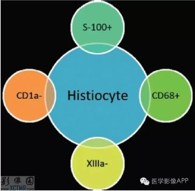 胸部组织细胞病影像学表现 胸部组织细胞病影像学表现