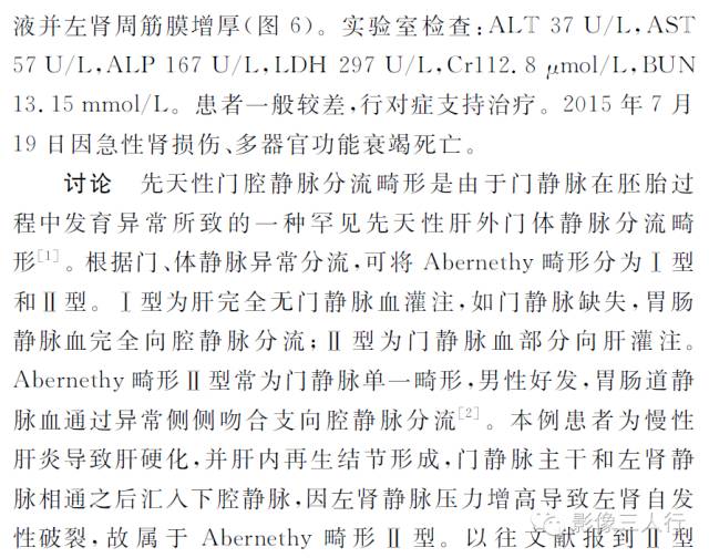 【病例】Abernethy畸形并左肾自发性破裂一例 【病例】Abernethy畸形并左肾自发性破裂一例