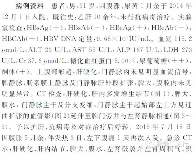 【病例】Abernethy畸形并左肾自发性破裂一例 【病例】Abernethy畸形并左肾自发性破裂一例