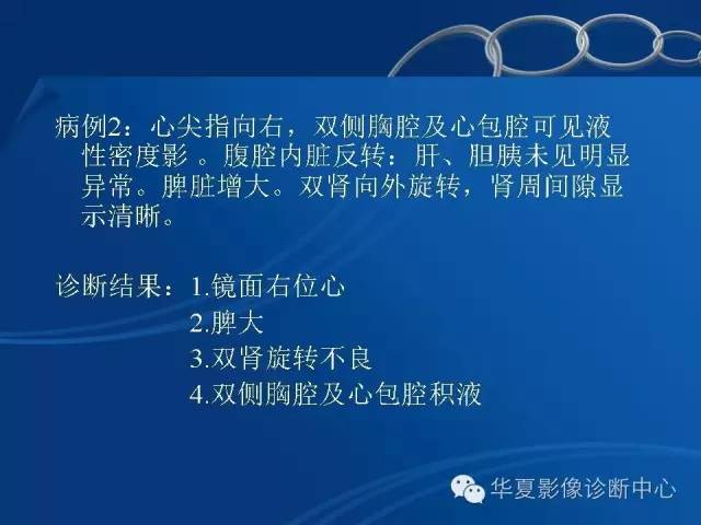 【PPT】先天性心脏、大血管位置异常
