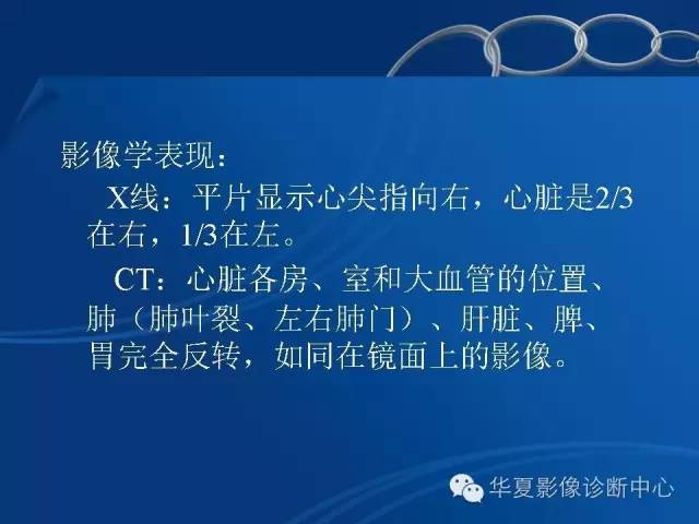 【PPT】先天性心脏、大血管位置异常