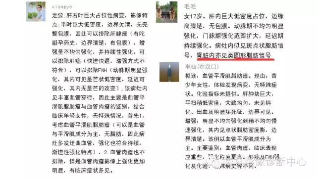 【病例】肝脏血管平滑肌脂肪瘤1例CT影像表现