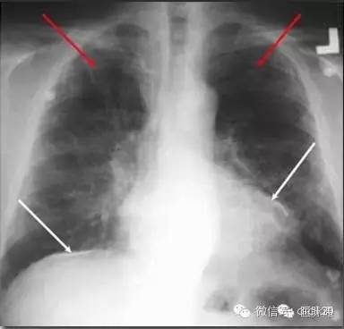X线诊断的细微关键点 X线诊断的细微关键点