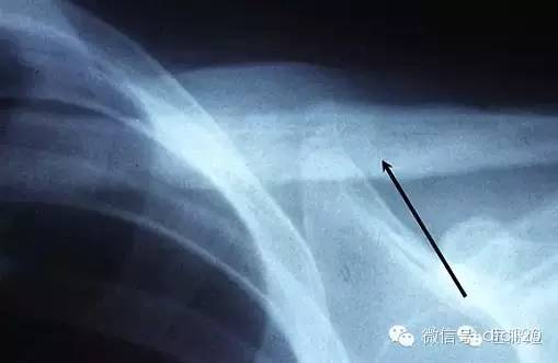 X线诊断的细微关键点 X线诊断的细微关键点