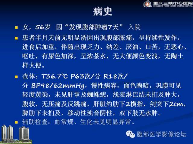 【病例】肠系膜韧带样纤维瘤1例CT影像表现