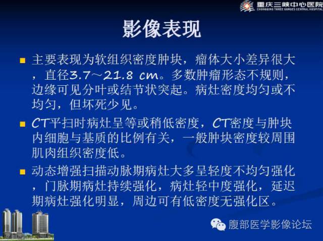 【病例】肠系膜韧带样纤维瘤1例CT影像表现 【病例】肠系膜韧带样纤维瘤1例CT影像表现