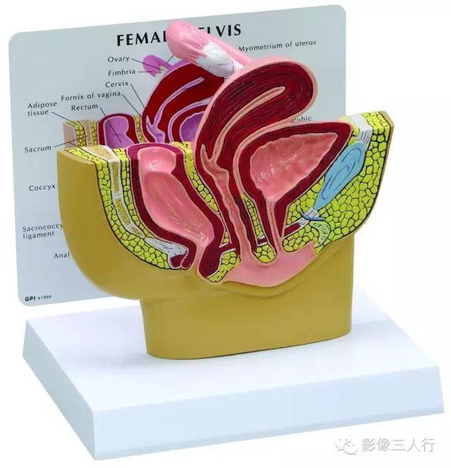 盆腔的陷凹及隐窝