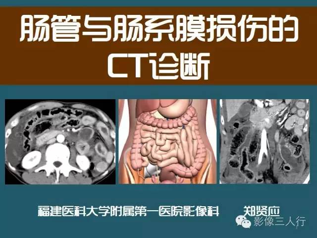 【PPT】肠管与肠系膜损伤的CT诊断