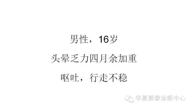 【病例】松果体区生殖细胞瘤1例CT及MR影像表现
