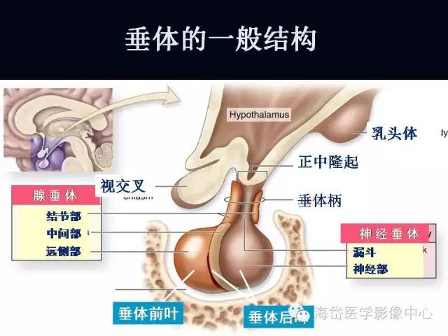 垂体柄阻断综合症MR表现