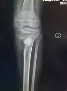 【】