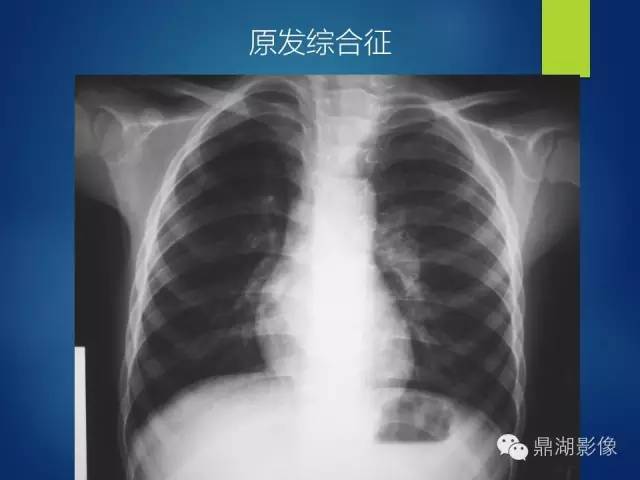40例典型胸片
