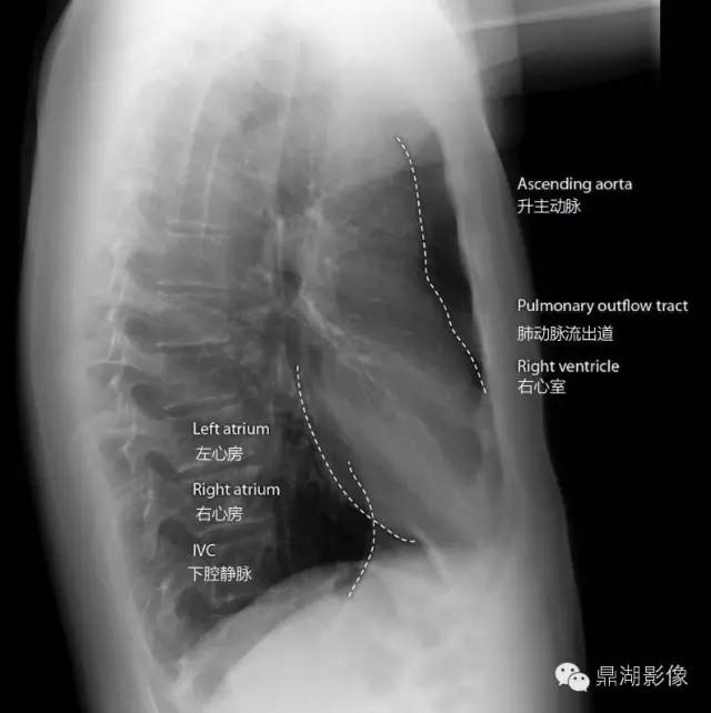 40例典型胸片
