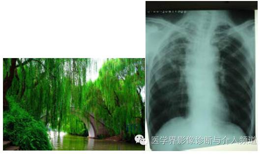 盘点：那些形象而有趣的影像学征象