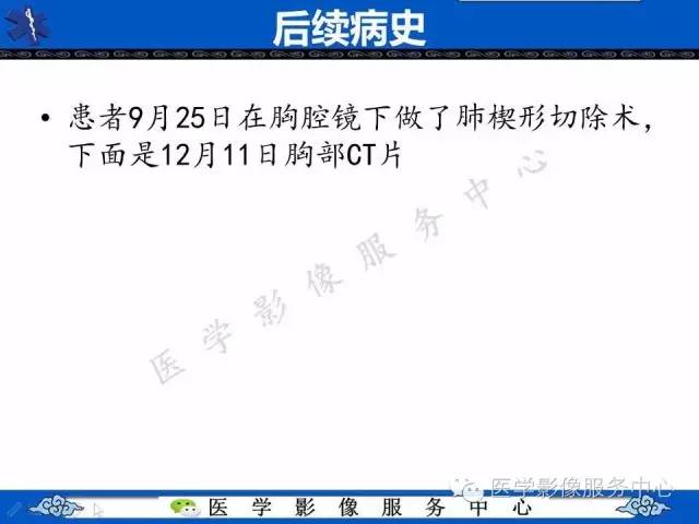 【病例】肺血管肉瘤1例CT影像表现