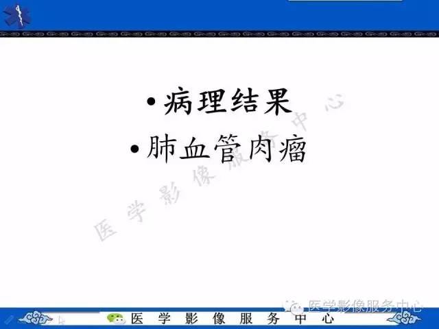 【病例】肺血管肉瘤1例CT影像表现